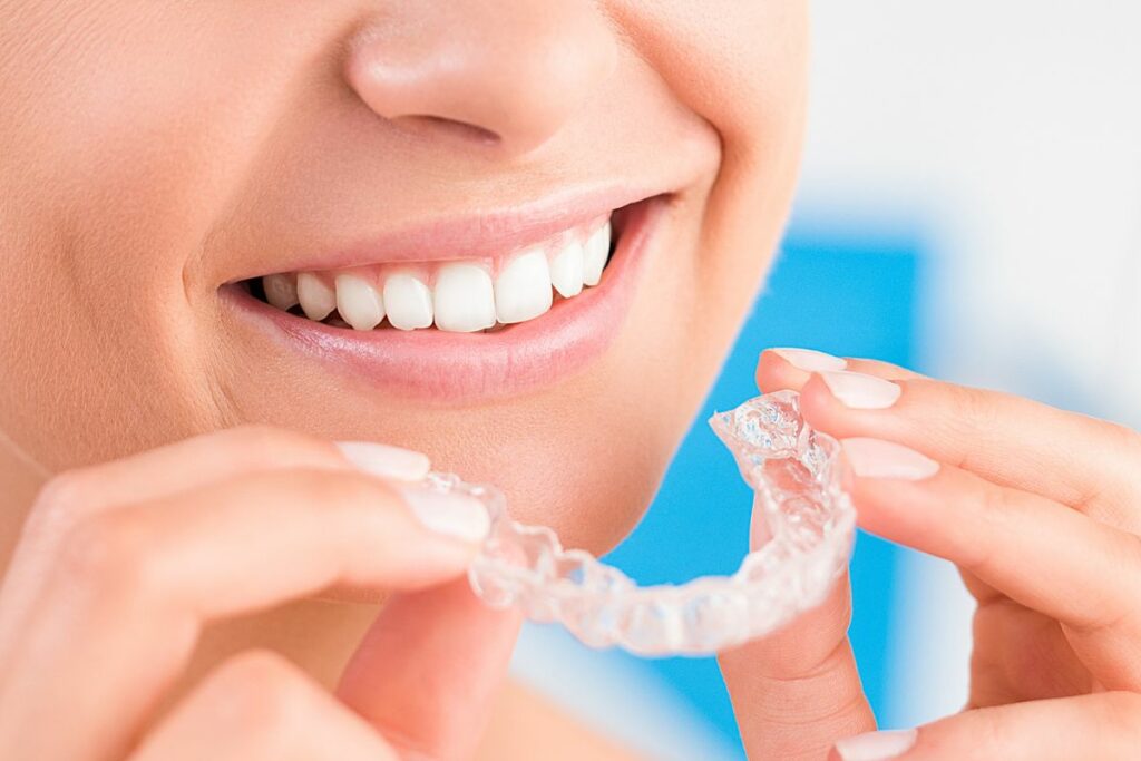 Invisalign Korea